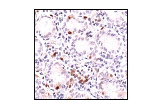 undefined Image 35: Human Reactive M1 vs M2 Macrophage IHC Antibody Sampler Kit