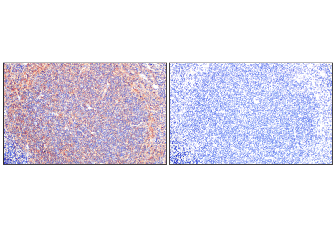 Immunohistochemistry Image 7: CCL3/MIP-1 alpha (F2M8Q) Rabbit Monoclonal Antibody