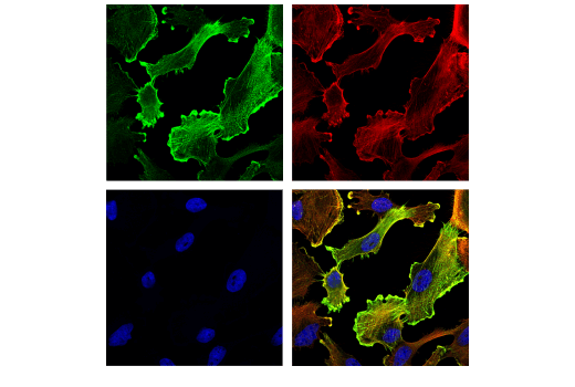 Immunofluorescence Image 1: alpha-Actinin (E7U1O) Mouse Monoclonal Antibody