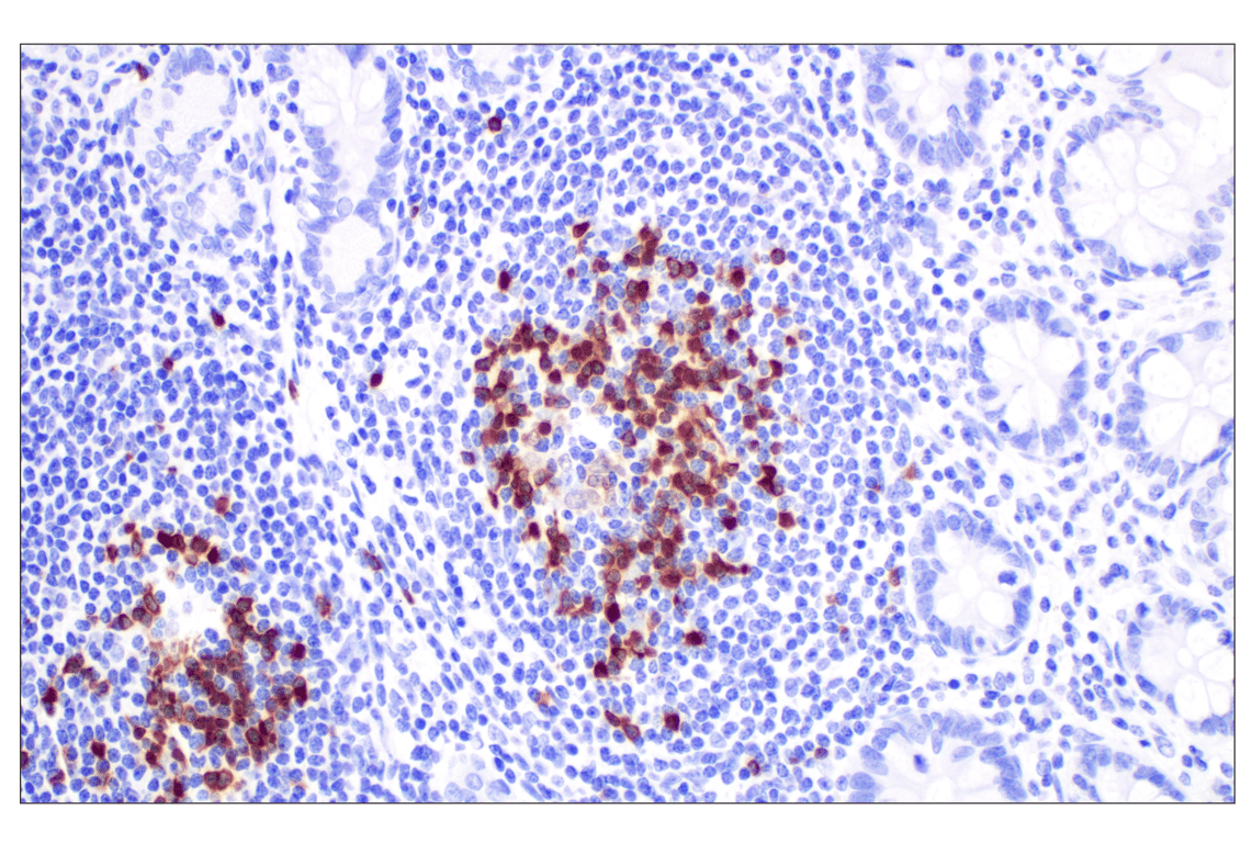 Immunohistochemistry Image 3: TCL1 (F9R1X) Rabbit Monoclonal Antibody