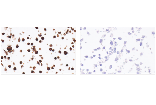 Immunohistochemistry Image 3: Perforin (E3W4I) Rabbit Monoclonal Antibody