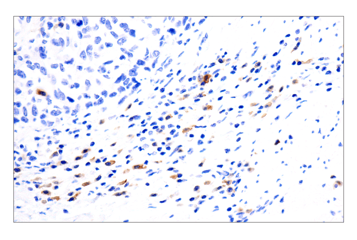 Immunohistochemistry Image 3: TNFRSF17/BCMA (E6D7B) Rabbit Monoclonal Antibody