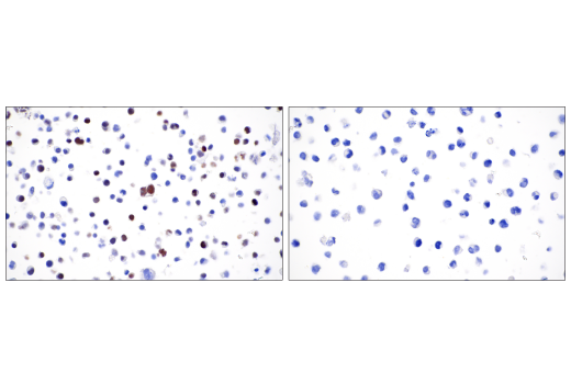 Immunohistochemistry Image 2: T-bet/TBX21 (D6N8B) Rabbit Monoclonal Antibody