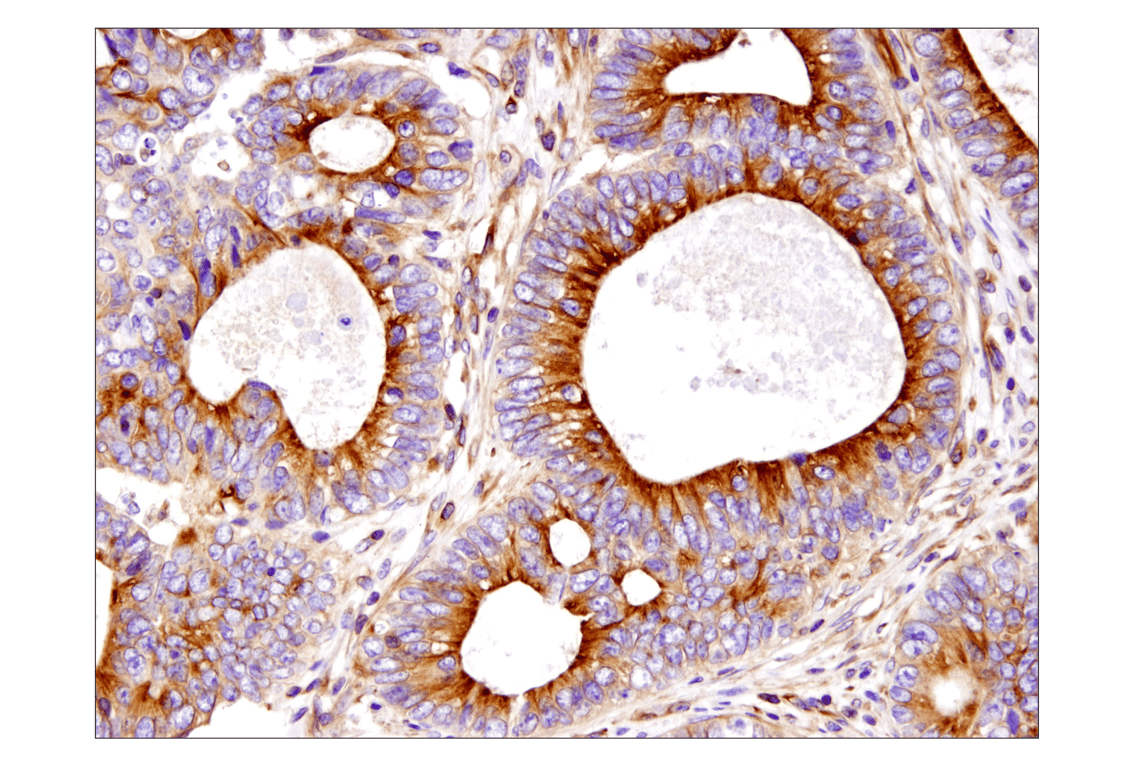 Immunohistochemistry Image 1: beta-Tubulin (D3U1W) Mouse Monoclonal Antibody