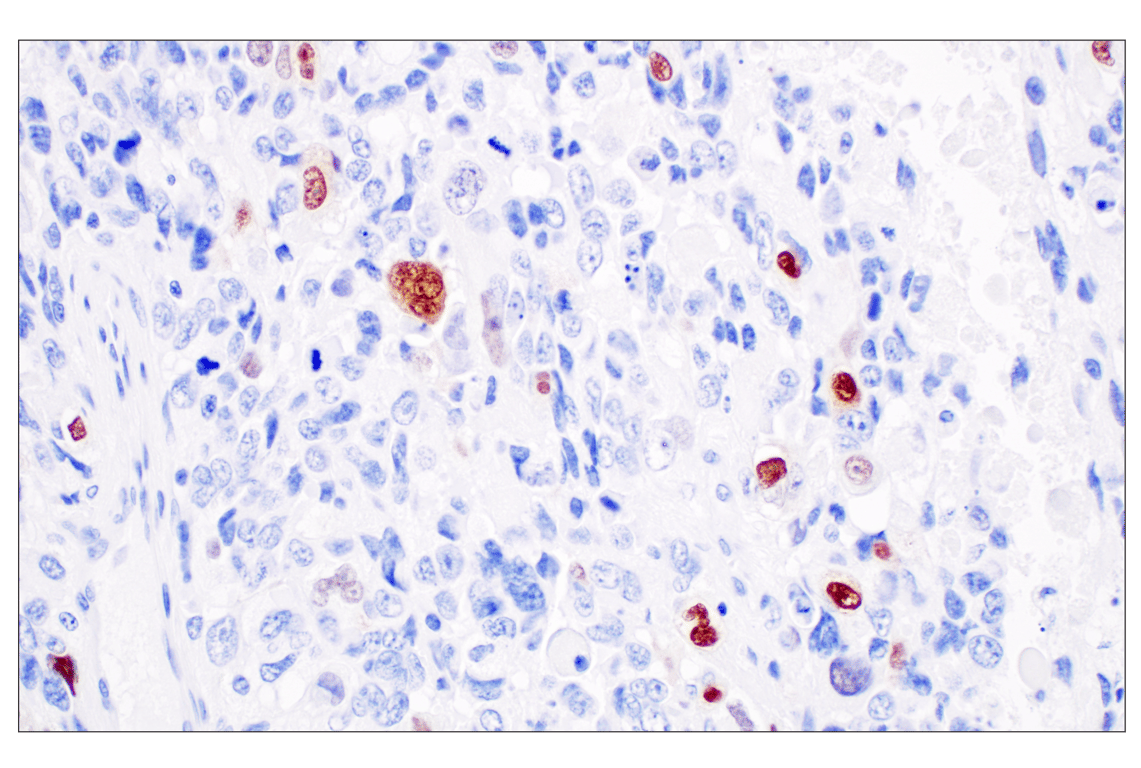 Immunohistochemistry Image 1: Myogenin (E9A1S) Rabbit Monoclonal Antibody