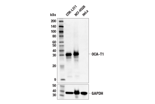 Western Blotting Image 1: OCA-T1 Antibody