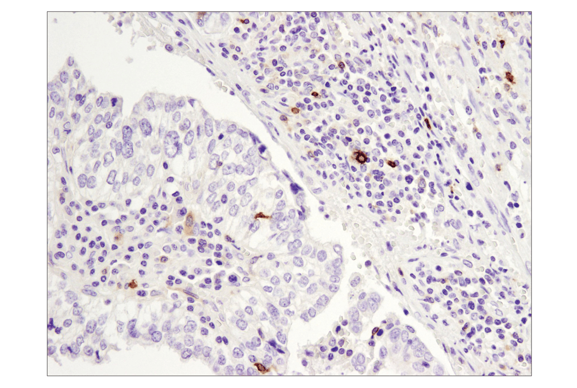 Immunohistochemistry Image 1: OX40 (E9U7O) Rabbit Monoclonal Antibody (BSA and Azide Free)
