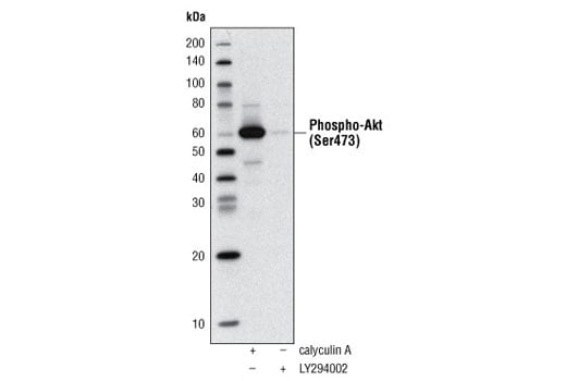 Western Blotting Image 1: Phospho-Akt (Ser473) (D9E) Rabbit Monoclonal Antibody (Biotinylated)