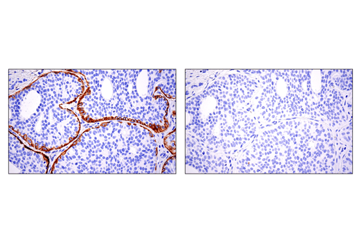 Immunohistochemistry Image 1: CD10/Neprilysin (E5P7S) Rabbit Monoclonal Antibody (BSA and Azide Free)