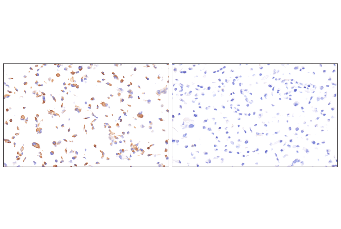 Immunohistochemistry Image 4: SDF1/CXCL12 (D8G6H) Rabbit Monoclonal Antibody