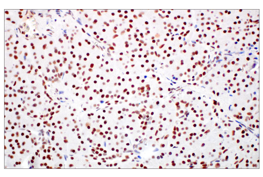 Immunohistochemistry Image 7: XRCC1 (E4A3V) Rabbit Monoclonal Antibody
