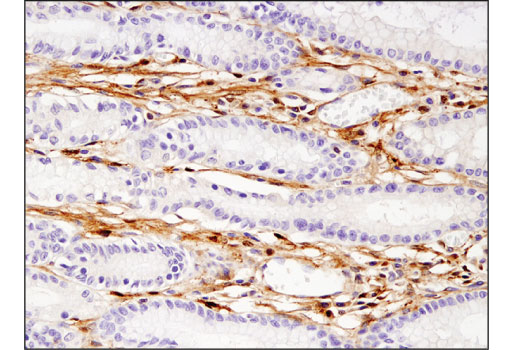 Immunohistochemistry Image 4: Galectin-1/LGALS1 (8A12) Mouse Monoclonal Antibody