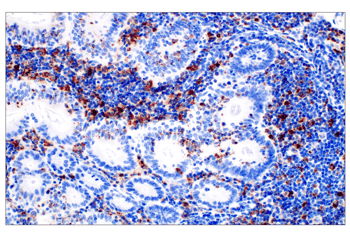 Immunohistochemistry Image 6: CD68 (E3O7V) Rabbit Monoclonal Antibody