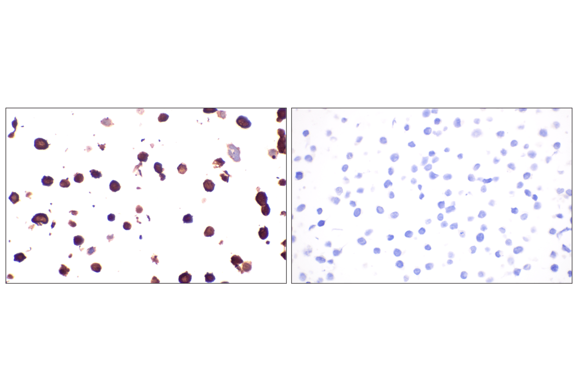 Immunohistochemistry Image 4: Influenza A Nucleoprotein (NP) (F8L6X) Rabbit Monoclonal Antibody