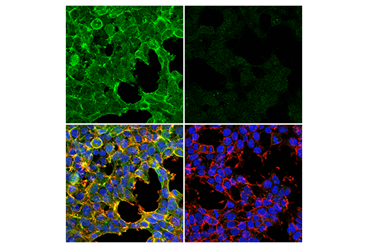 Immunofluorescence Image 1: MRCK alpha (E2S5I) Rabbit Monoclonal Antibody