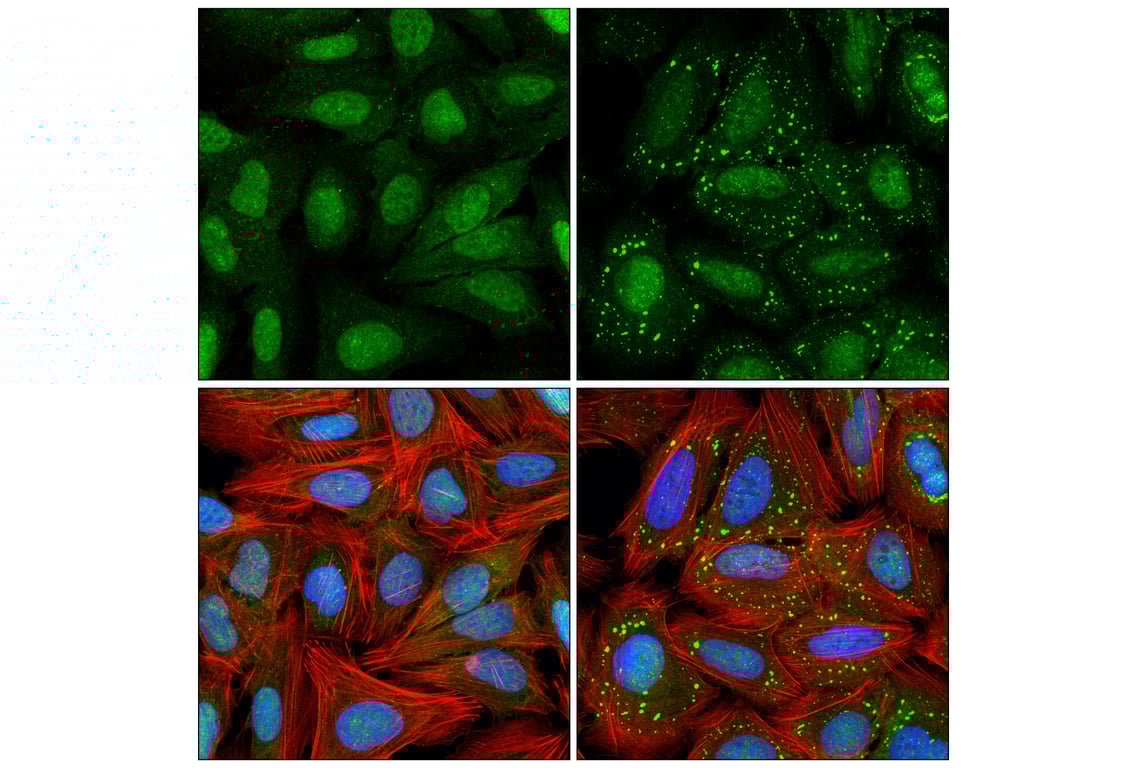 Immunofluorescence Image 1: RBM4 (E1Y2G) Rabbit Monoclonal Antibody