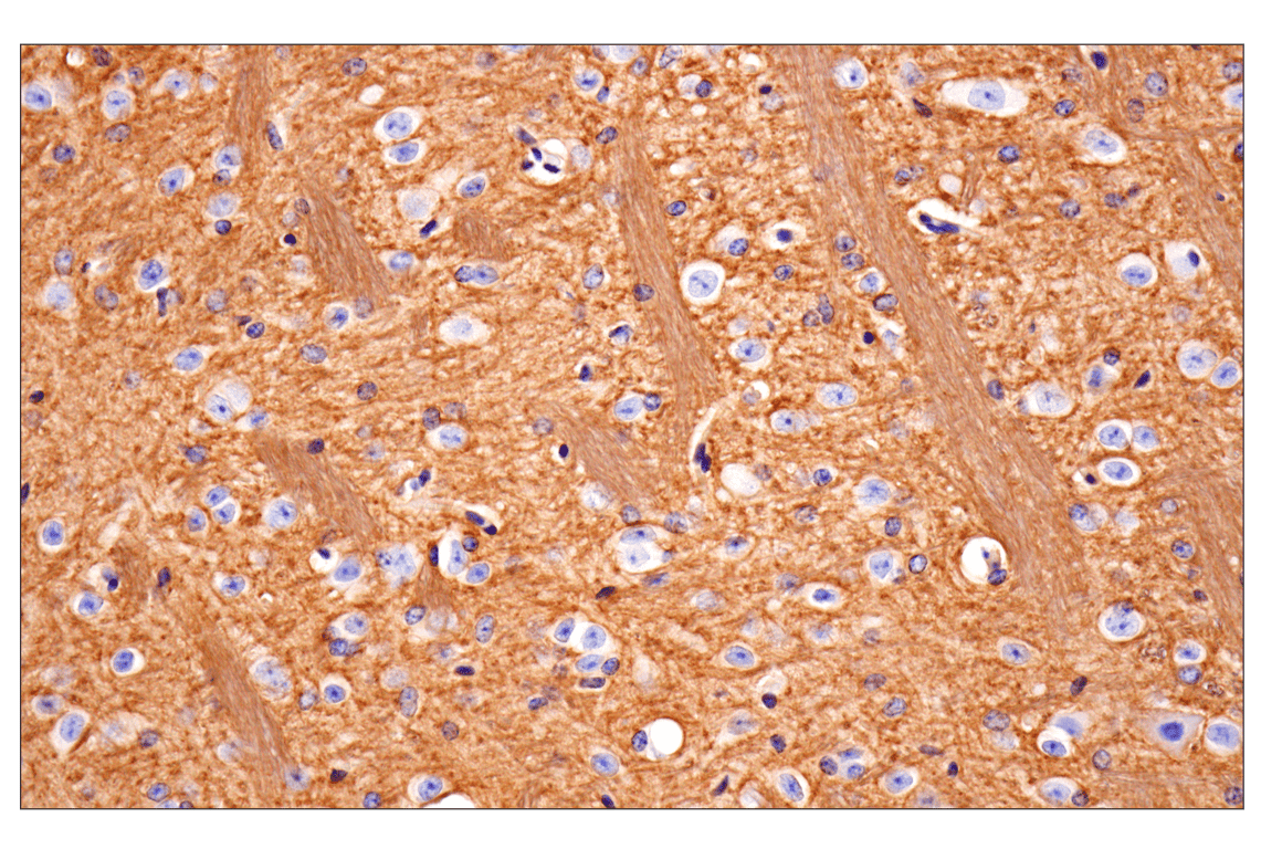 undefined Image 28: Mouse Reactive Exosome Marker Antibody Sampler Kit