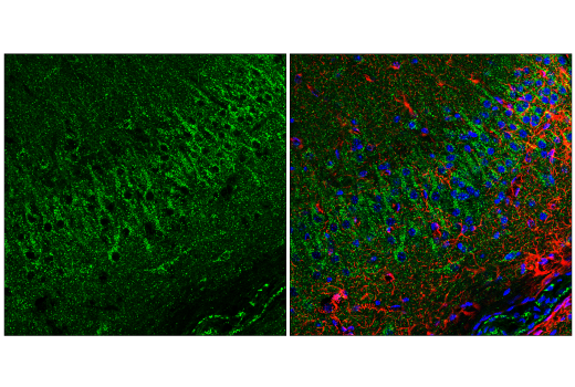 Immunofluorescence Image 2: EEA1 (E9Q6G) Mouse Monoclonal Antibody