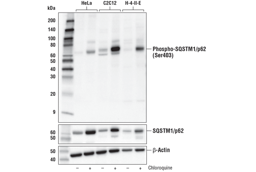 Western Blotting Image 2: Phospho-SQSTM1/p62 (Ser403) (D8D6T) Rabbit Monoclonal Antibody