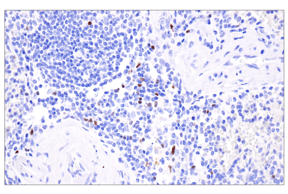Immunohistochemistry Image 8: FoxP3 (221D) Mouse Monoclonal Antibody