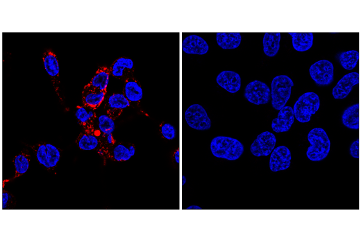 Immunofluorescence Image 1: CD68 (D4B9C) Rabbit Monoclonal Antibody (Alexa Fluor<sup>®</sup> 647 Conjugate)