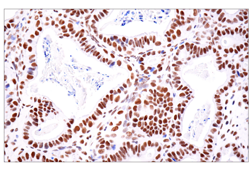 Immunohistochemistry Image 5: ATRX (E5X7O) Rabbit Monoclonal Antibody