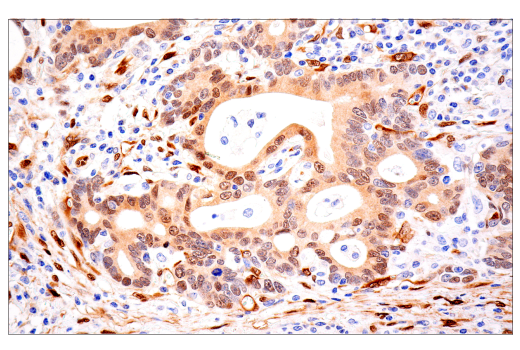 Immunohistochemistry Image 5: TAZ (E9J5A) Rabbit Monoclonal Antibody (BSA and Azide Free)