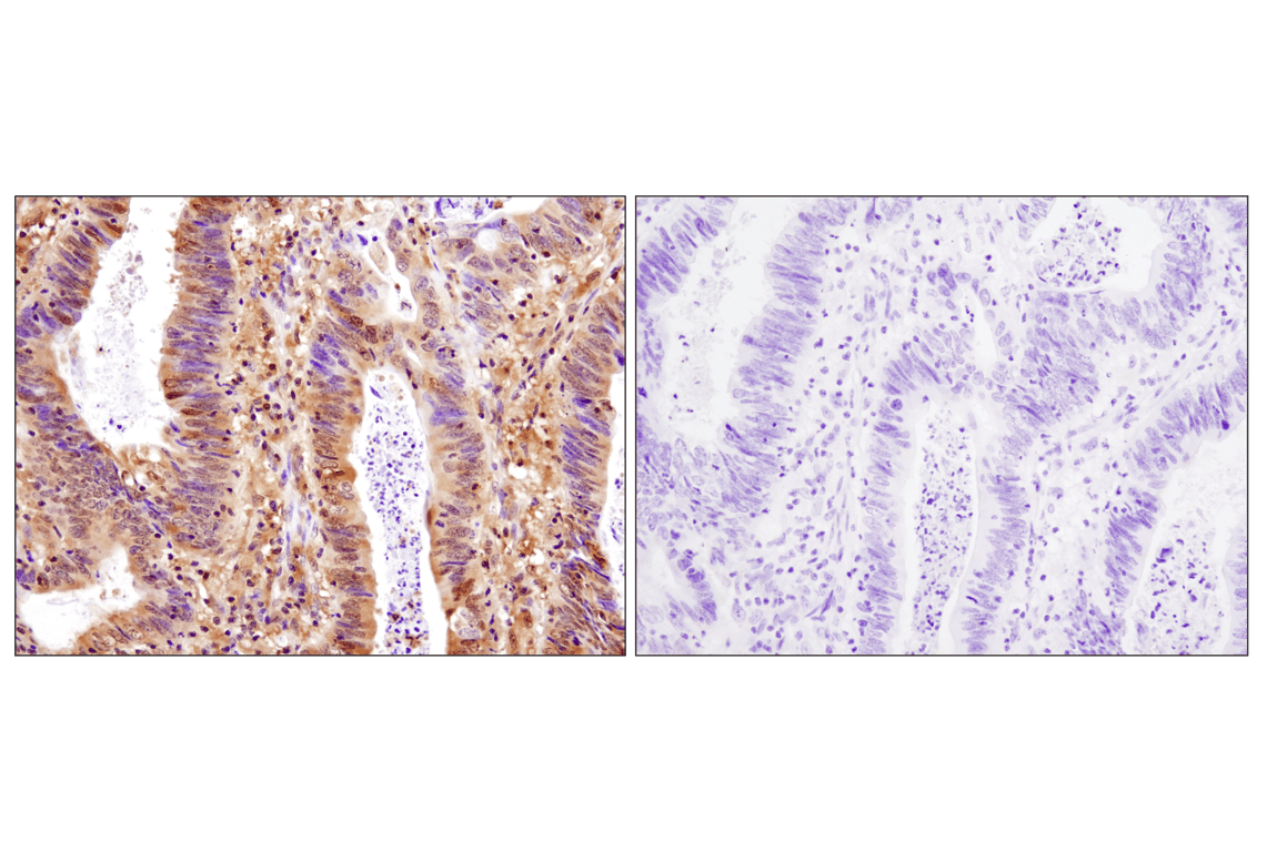 Immunohistochemistry Image 2: Stat3 alpha (D1A5) Rabbit Monoclonal Antibody (BSA and Azide Free)