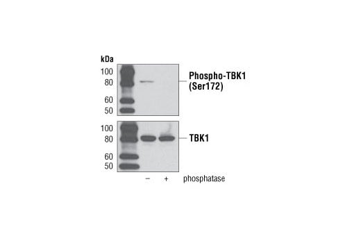 Western Blotting Image 2: Phospho-TBK1/NAK (Ser172) (D52C2) Rabbit Monoclonal Antibody (BSA and Azide Free)