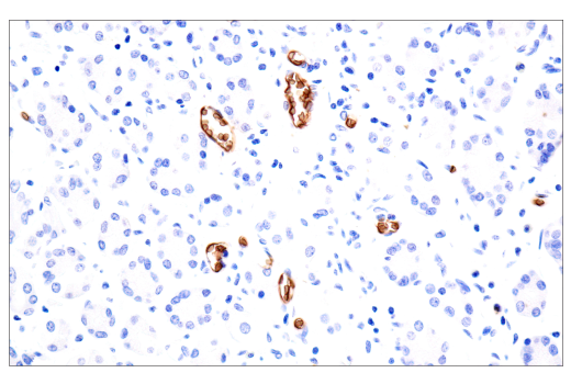 Immunohistochemistry Image 5: CD235a/Glycophorin A (JC159) Rabbit Monoclonal Antibody