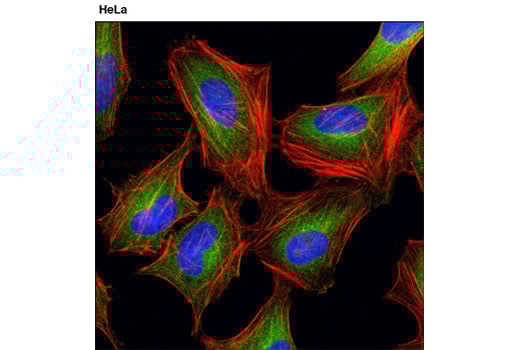 undefined Image 3: PhosphoPlus<sup>®</sup> MEK1/2 (Ser217/Ser221) Antibody Duet