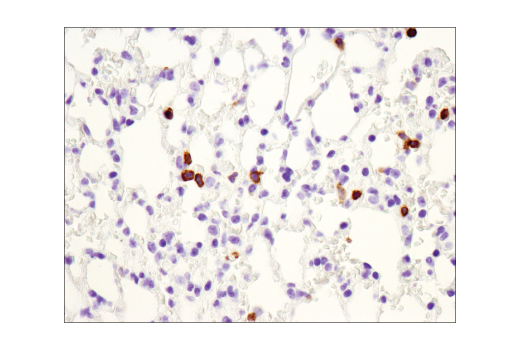 Immunohistochemistry Image 3: CD3 epsilon (D4V8L) Rabbit Monoclonal Antibody (BSA and Azide Free)