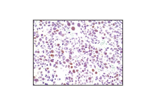 Immunohistochemistry Image 2: CDK9 (C12F7) Rabbit Monoclonal Antibody (BSA and Azide Free)