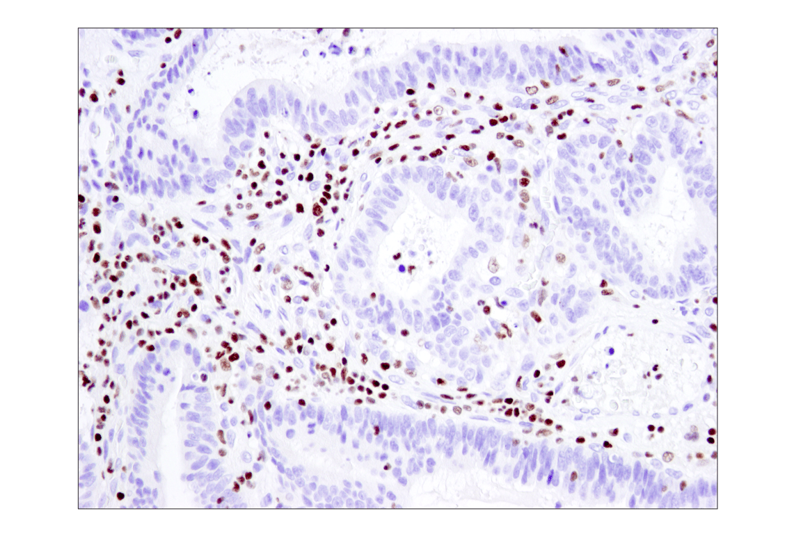 Immunohistochemistry Image 1: Ikaros (D6N9Y) Rabbit Monoclonal Antibody