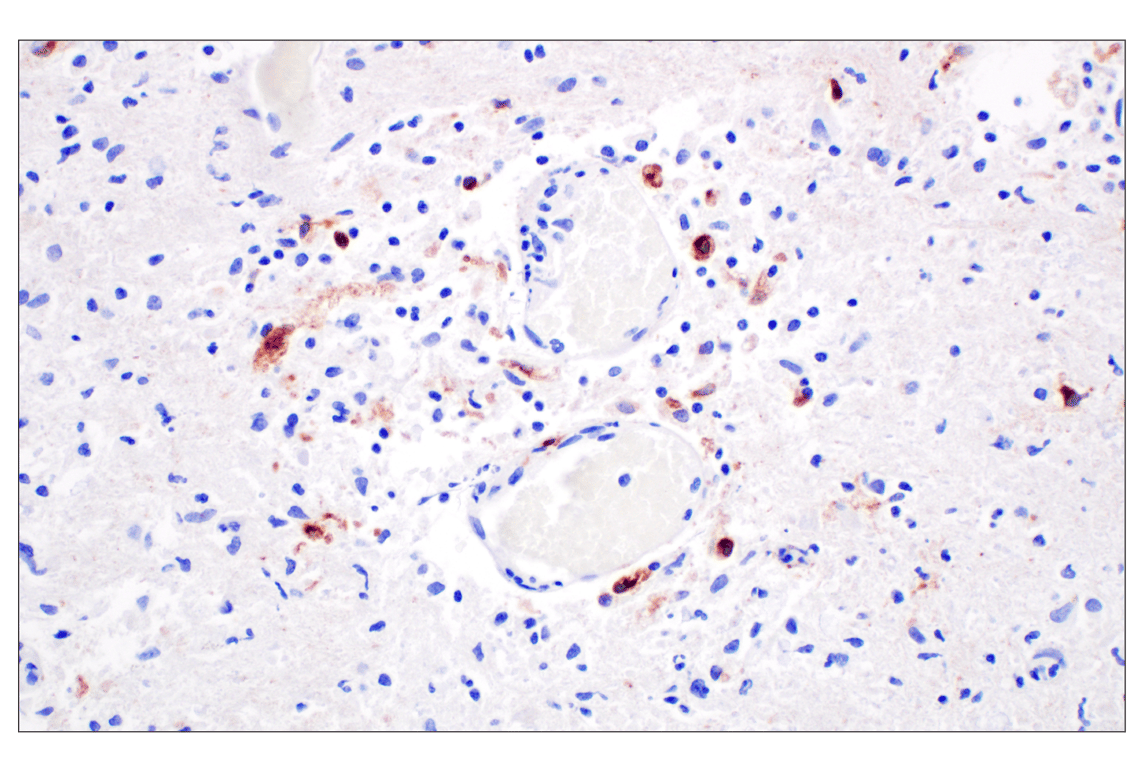 Immunohistochemistry Image 5: CXCL13 (F6A4R) Rabbit Monoclonal Antibody