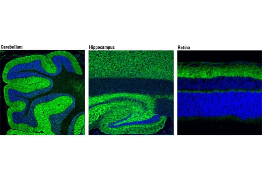 Immunofluorescence Image 1: Bassoon (D63B6) Rabbit Monoclonal Antibody (BSA and Azide Free)