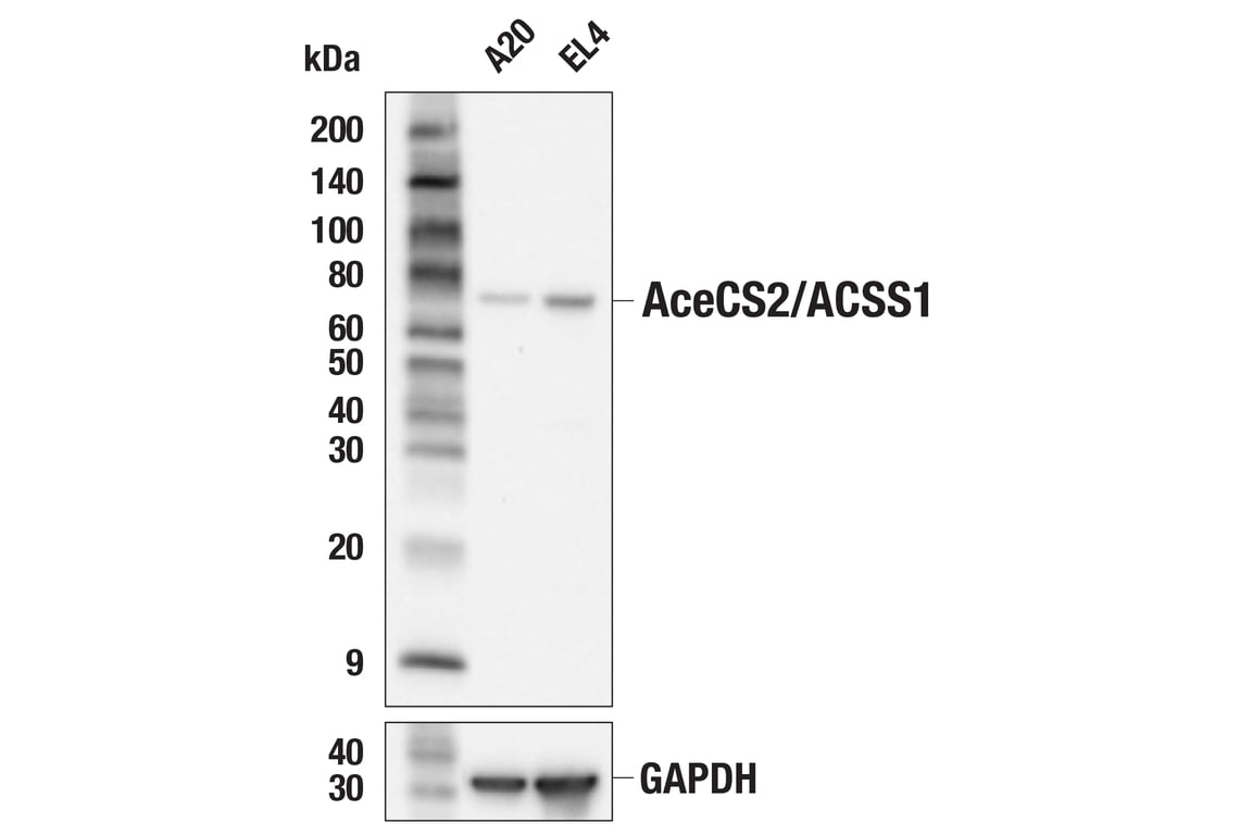 Western Blotting Image 3: AceCS2/ACSS1 (E6T5E) Rabbit Monoclonal Antibody
