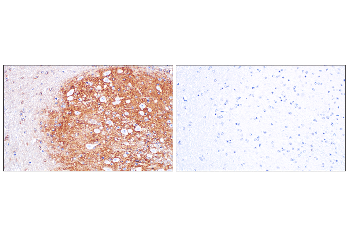 Immunohistochemistry Image 2: Kir4.1 (F5Z2T) Rabbit Monoclonal Antibody