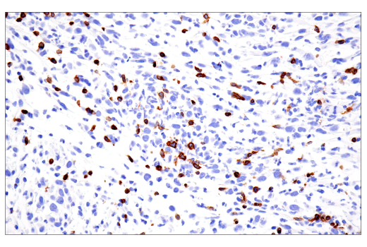 Immunohistochemistry Image 3: CD3 epsilon (E4T1B) Rabbit Monoclonal Antibody (BSA and Azide Free)