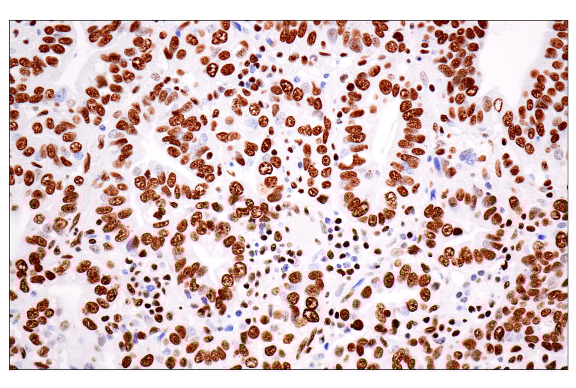 Immunohistochemistry Image 1: ILF3 (E5H6F) Rabbit Monoclonal Antibody