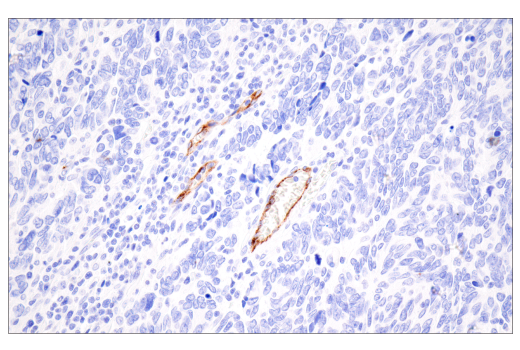 Immunohistochemistry Image 3: CD62P/P-Selectin (E8Q1W) Rabbit Monoclonal Antibody