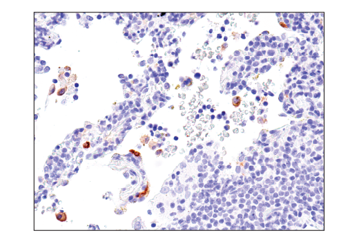 Immunohistochemistry Image 3: Axl (C89E7) Rabbit Monoclonal Antibody