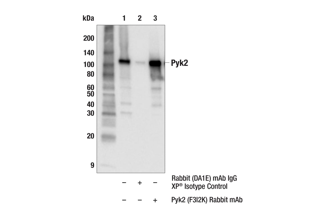 Immunoprecipitation Image 1: Pyk2 (F3I2K) Rabbit Monoclonal Antibody