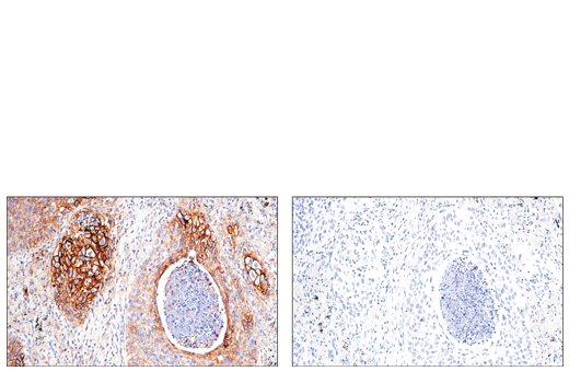 Immunohistochemistry Image 7: CD54/ICAM-1 (E3Q9N) Rabbit Monoclonal Antibody (BSA and Azide Free)
