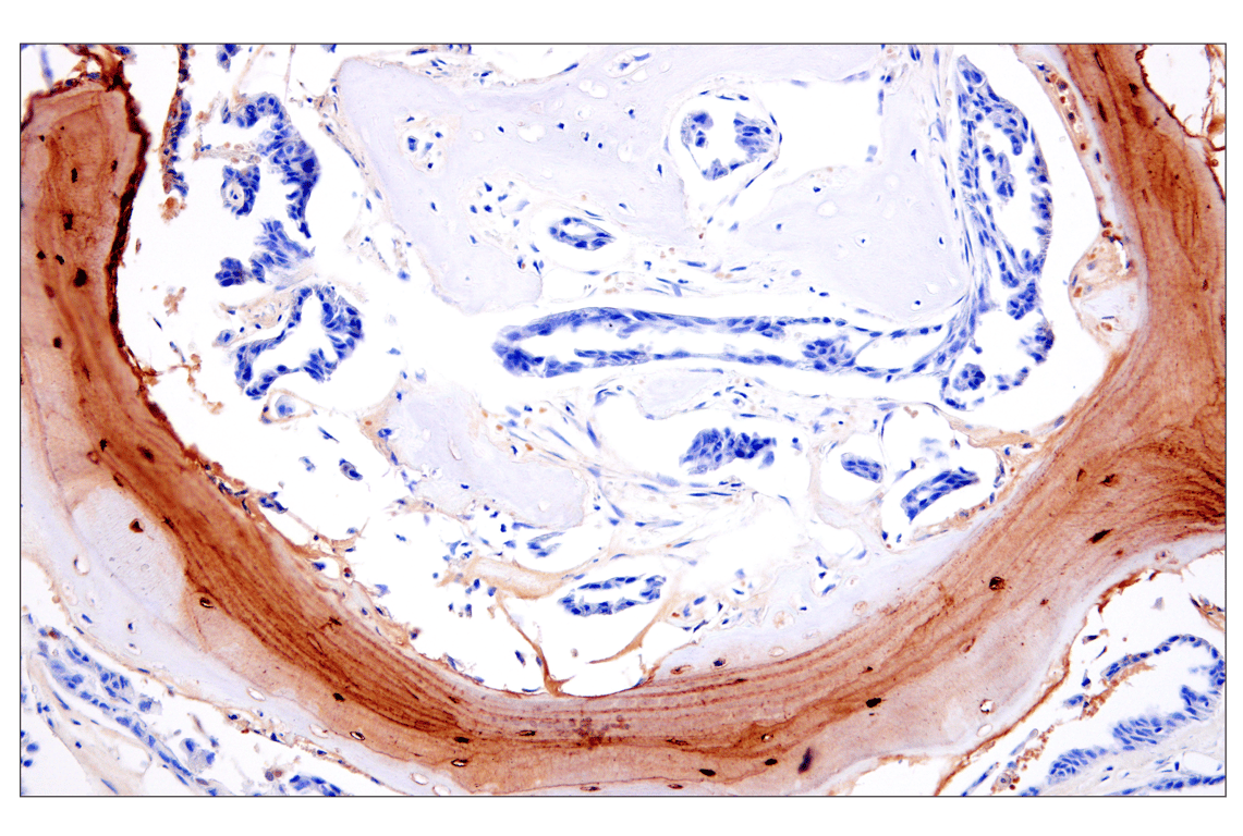 Immunohistochemistry Image 3: Osteocalcin (E8B9X) Rabbit Monoclonal Antibody
