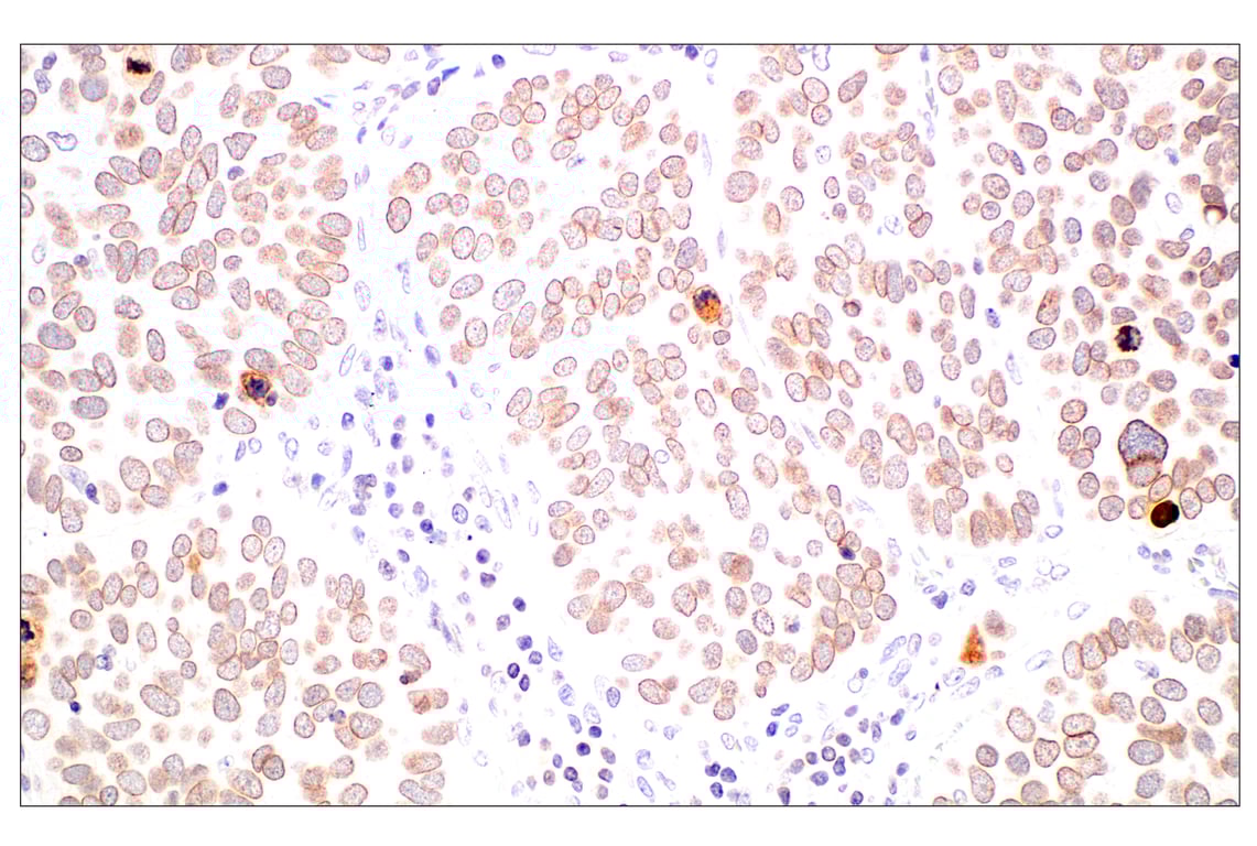 Immunohistochemistry Image 1: POM121 (E3W3J) Rabbit Monoclonal Antibody