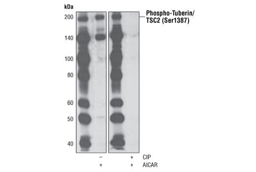 undefined Image 7: Phospho-TSC2 Antibody Sampler Kit