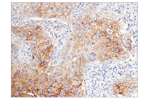 Immunohistochemistry Image 3: CD47 (D3O7P) Rabbit Monoclonal Antibody (BSA and Azide Free)
