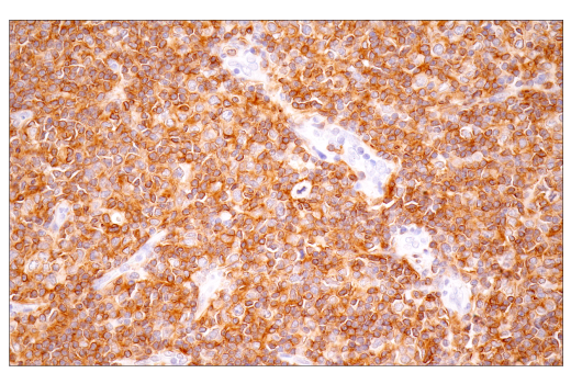 Immunohistochemistry Image 2: TNFRSF13C/BAFF-R (E3C1Q) Rabbit Monoclonal Antibody (BSA and Azide Free)
