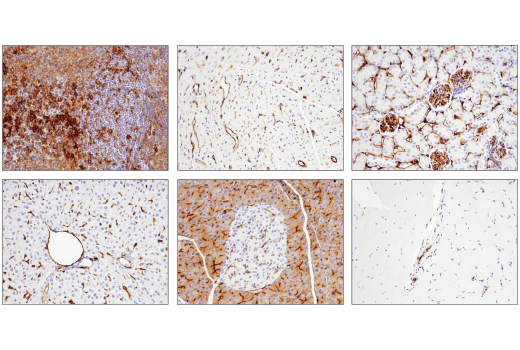 Immunohistochemistry Image 1: CD39/NTPDase 1 (E2X6B) Rabbit Monoclonal Antibody (BSA and Azide Free)